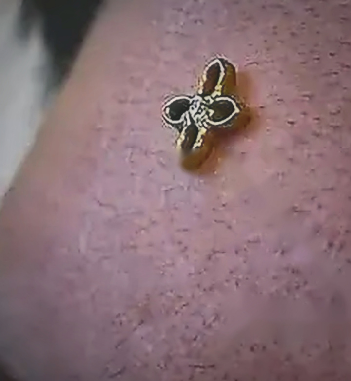 Microdermal Oro — Byron López en Abyss Tattoo Studio